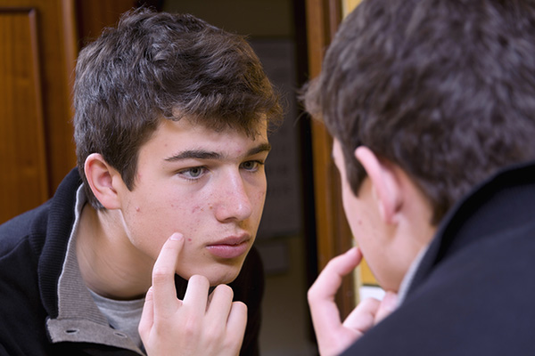 male teen with acne